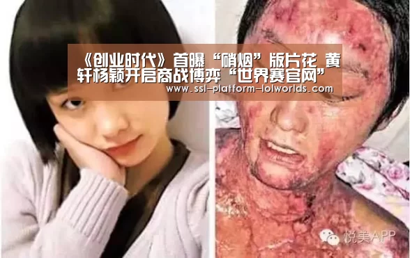 全球总决赛官网